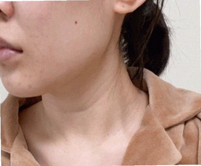 얼굴각질제거 홈케어 참고 이미지