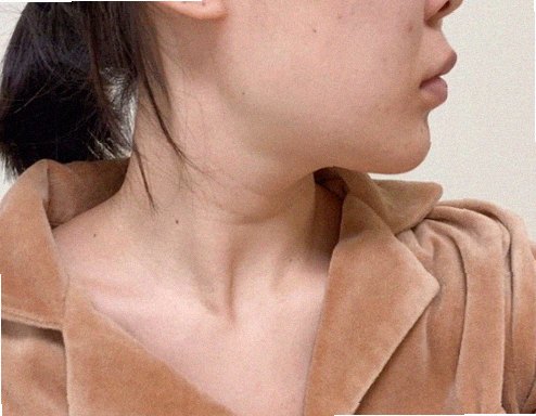 얼굴각질제거 관리 참고 이미지