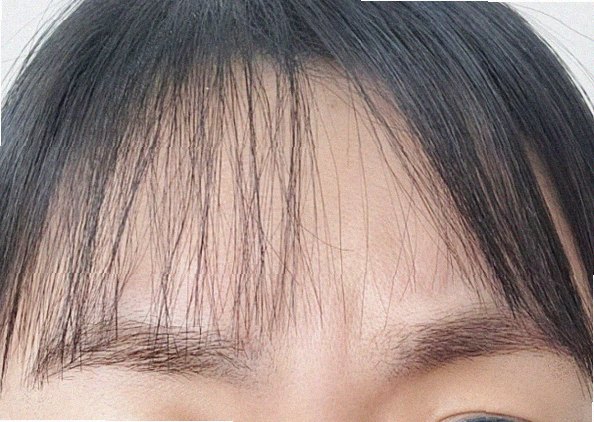 얼굴피지제거 홈케어 안내 대표 이미지
