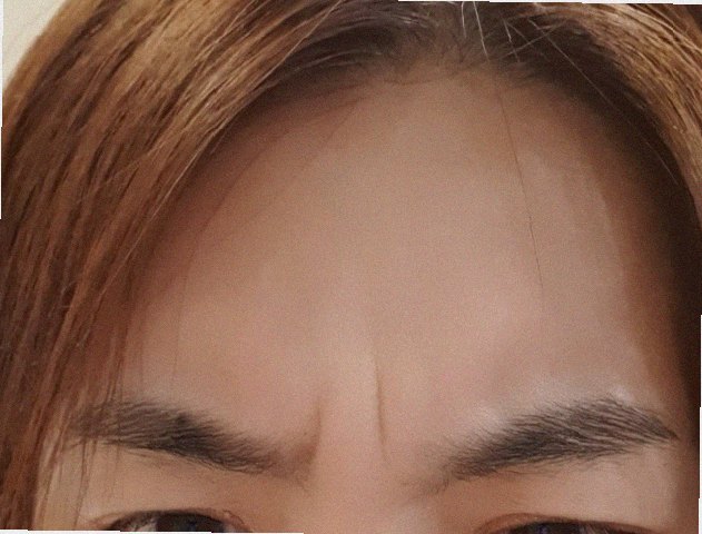얼굴피지제거 관리 참고 이미지