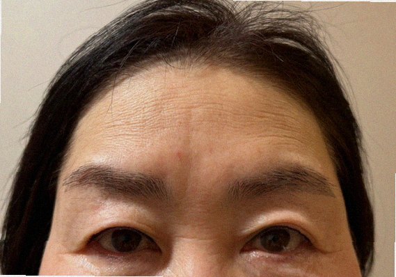 모공줄이는법 홈케어 참고 이미지