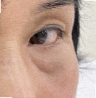 다크서클없애는법 관리 참고 이미지