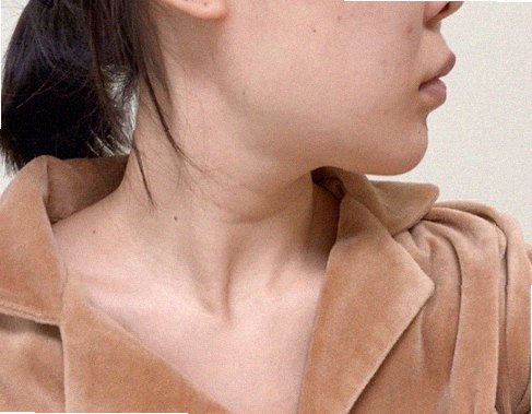 피부탄력관리법 관리 참고 이미지