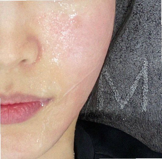 요철없애는법 홈케어 안내 대표 이미지