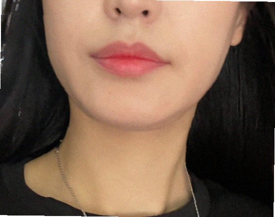 요철없애는법 홈케어 참고 이미지