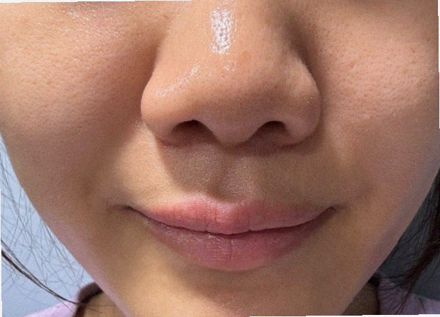 팔자주름없애기 홈케어 참고 이미지