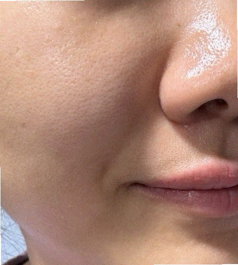 팔자주름없애기 관리 참고 이미지