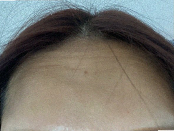 블랙헤드제거 홈케어 안내 대표 이미지