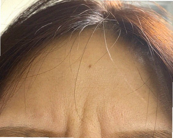 블랙헤드제거 홈케어 참고 이미지