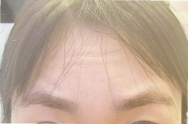 블랙헤드제거 관리 참고 이미지
